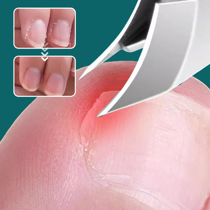 ✨【Extra ajándék】Professzionális körömvágó olló szett + INGYEN fülkefészettel! ✂️👂